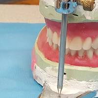 Вижте каталога ни с Dental Implants Bulgaria 13