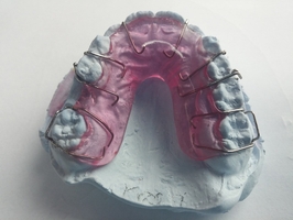 Offers for Invisalign 34