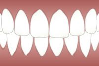 Огромно разнообразие от зъбни импланти софия 29