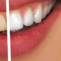 Намерете най-добрите оферти за зъболекар софия 15