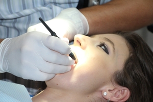 Spectacular Dental Implants 30